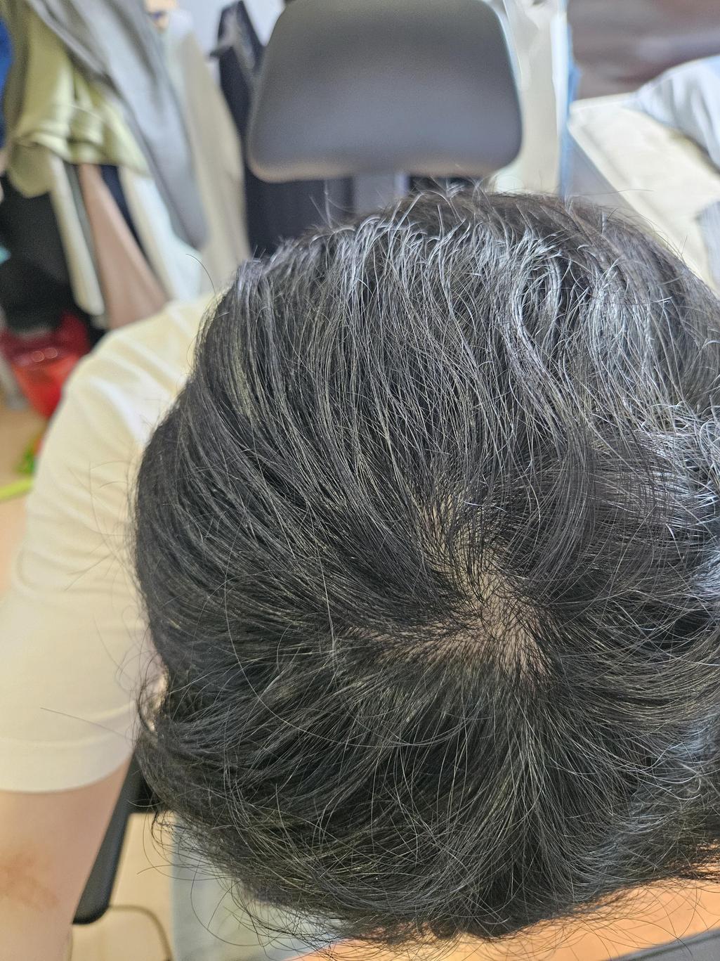 2번 째 사진