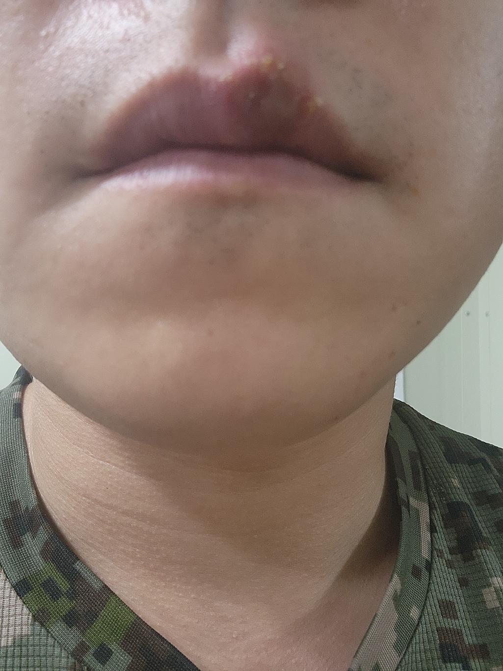 2번 째 사진