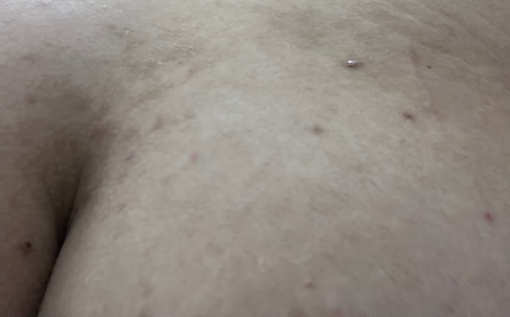 3번 째 사진
