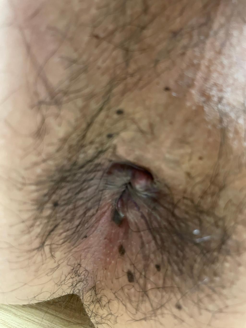 4번 째 사진