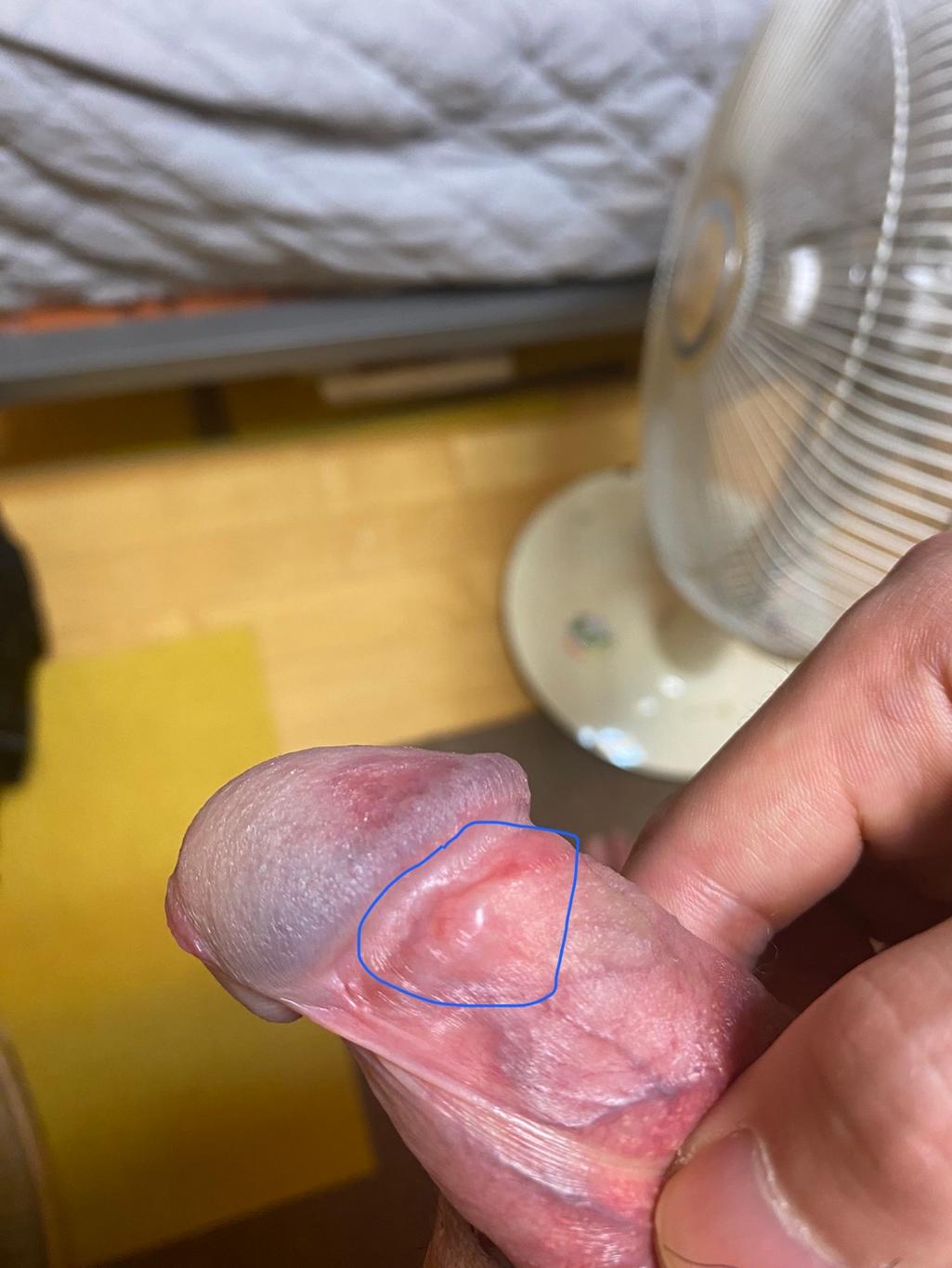 3번 째 사진