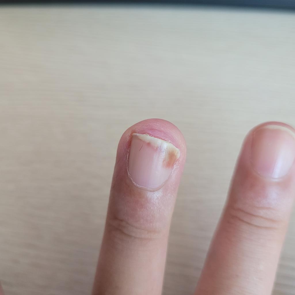 3번 째 사진