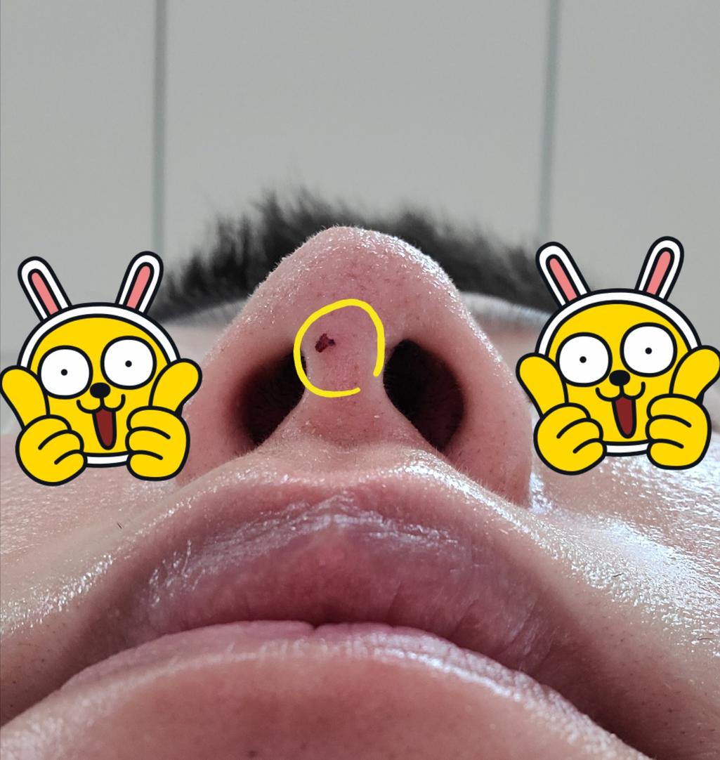 1번 째 사진