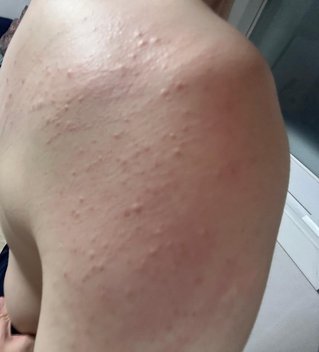 2번 째 사진
