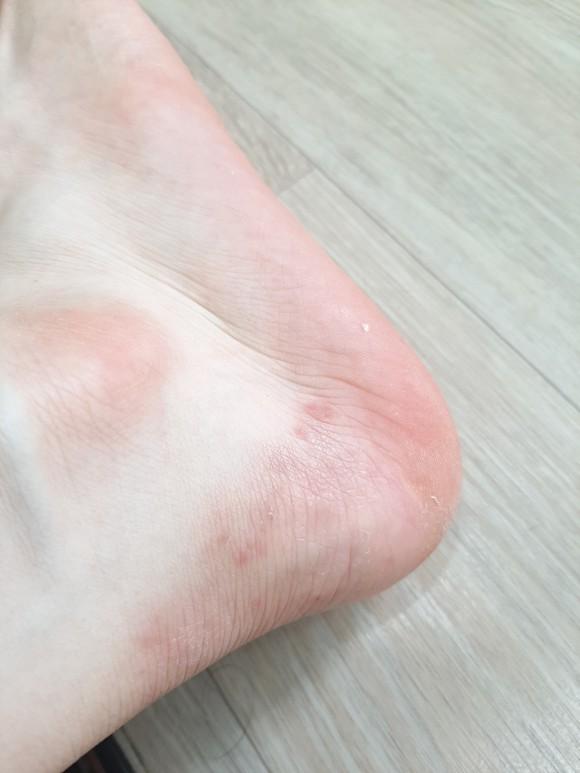 2번 째 사진