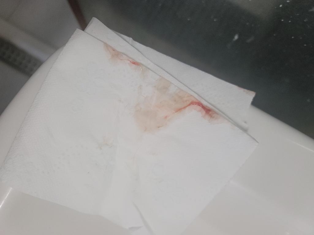 2번 째 사진