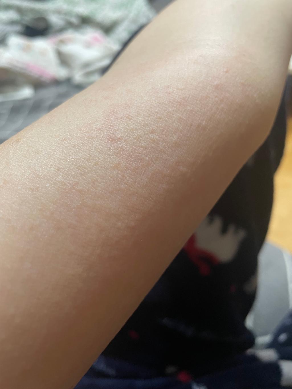 2번 째 사진