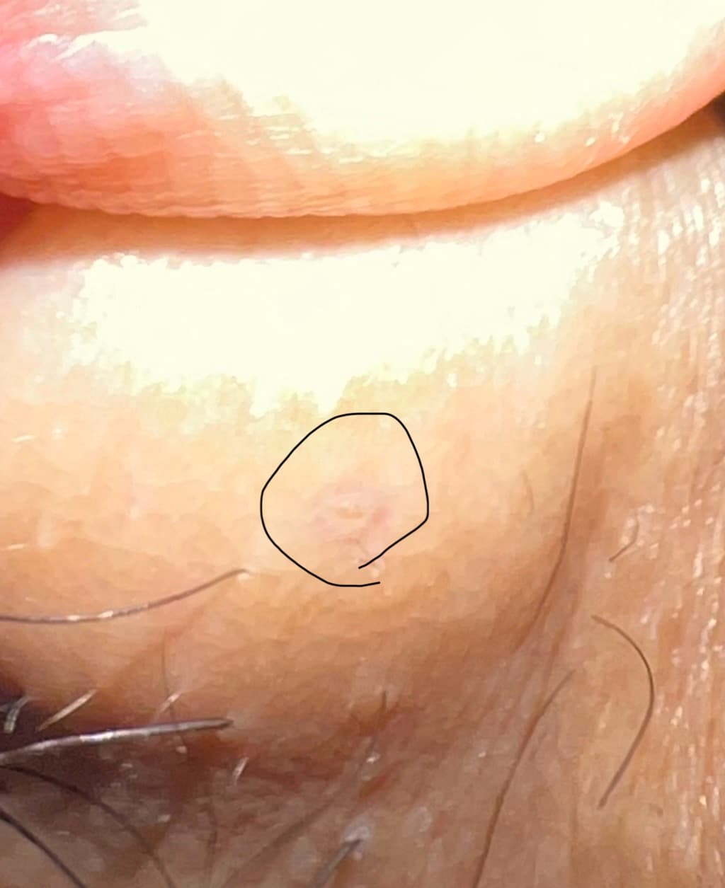 14번 째 사진