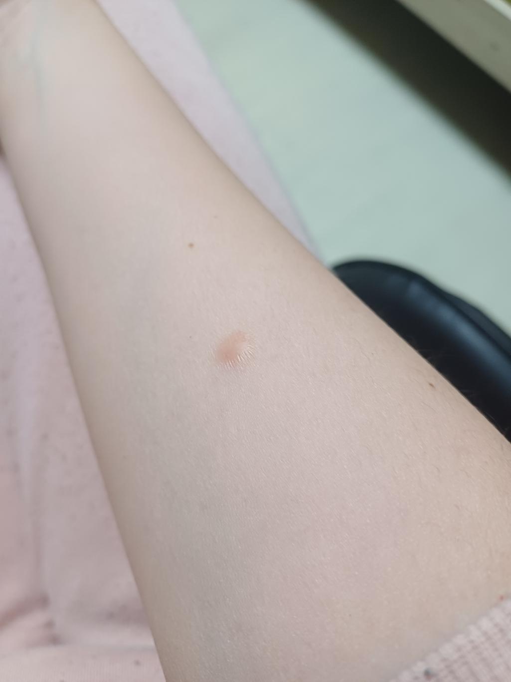 2번 째 사진