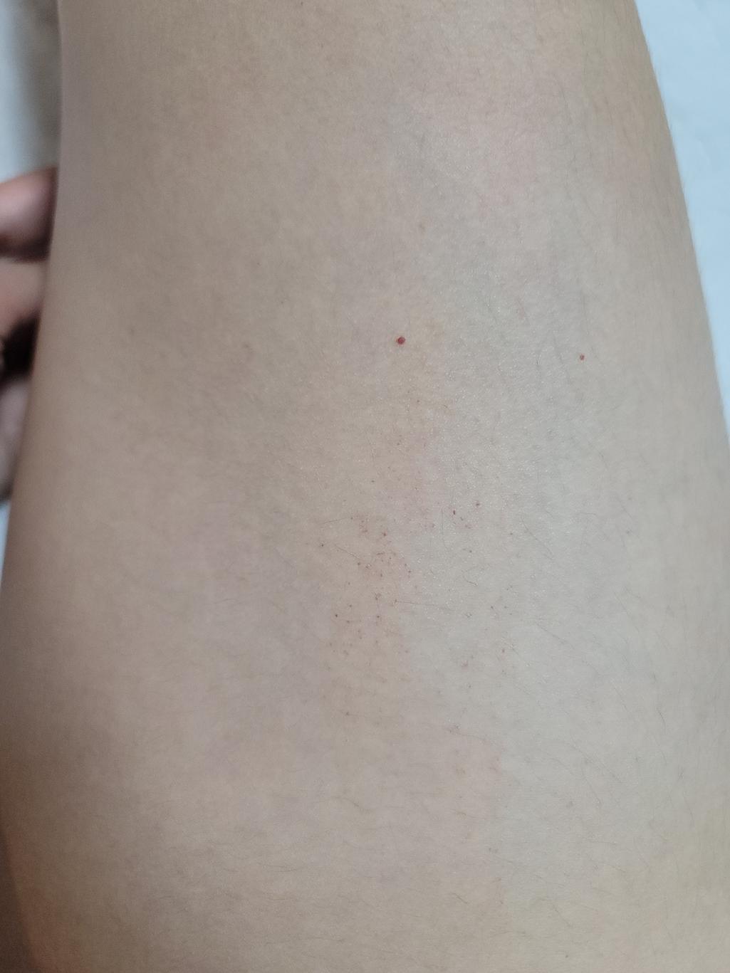 2번 째 사진