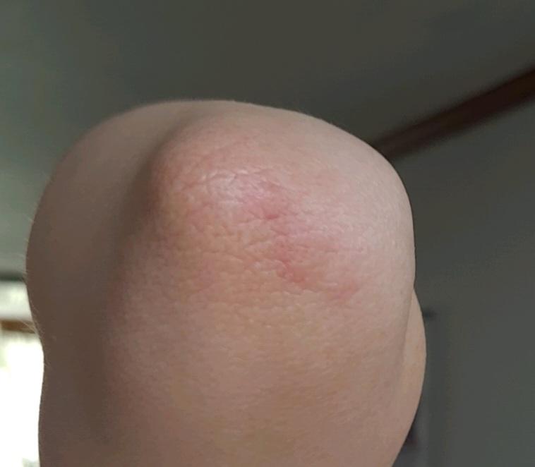 2번 째 사진