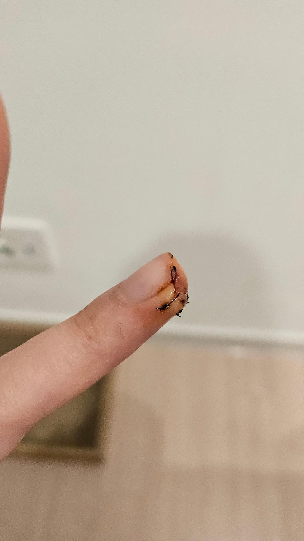 2번 째 사진