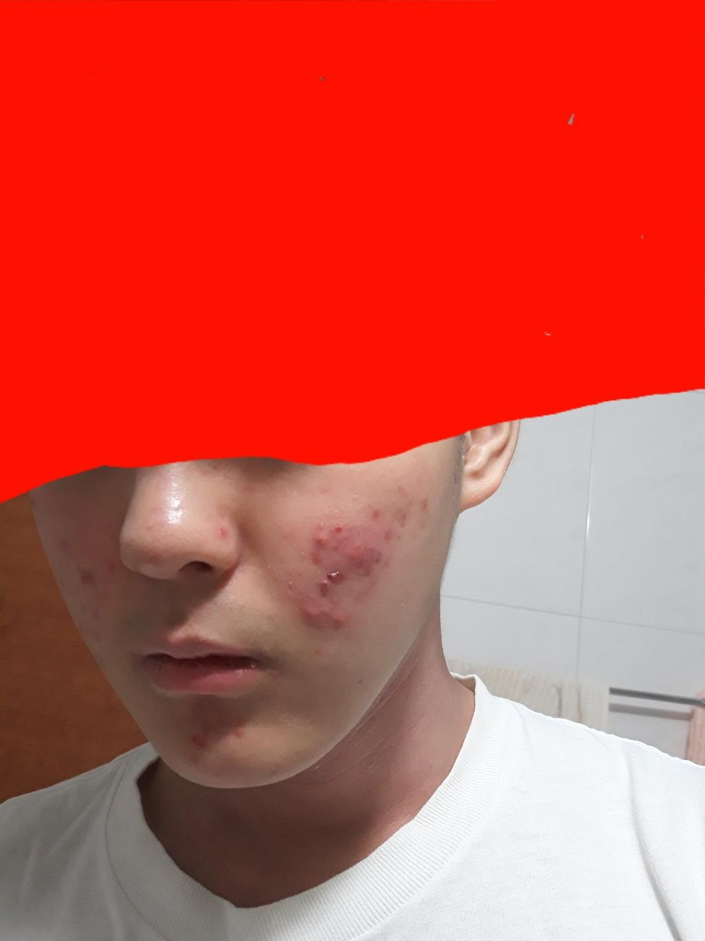 1번 째 사진