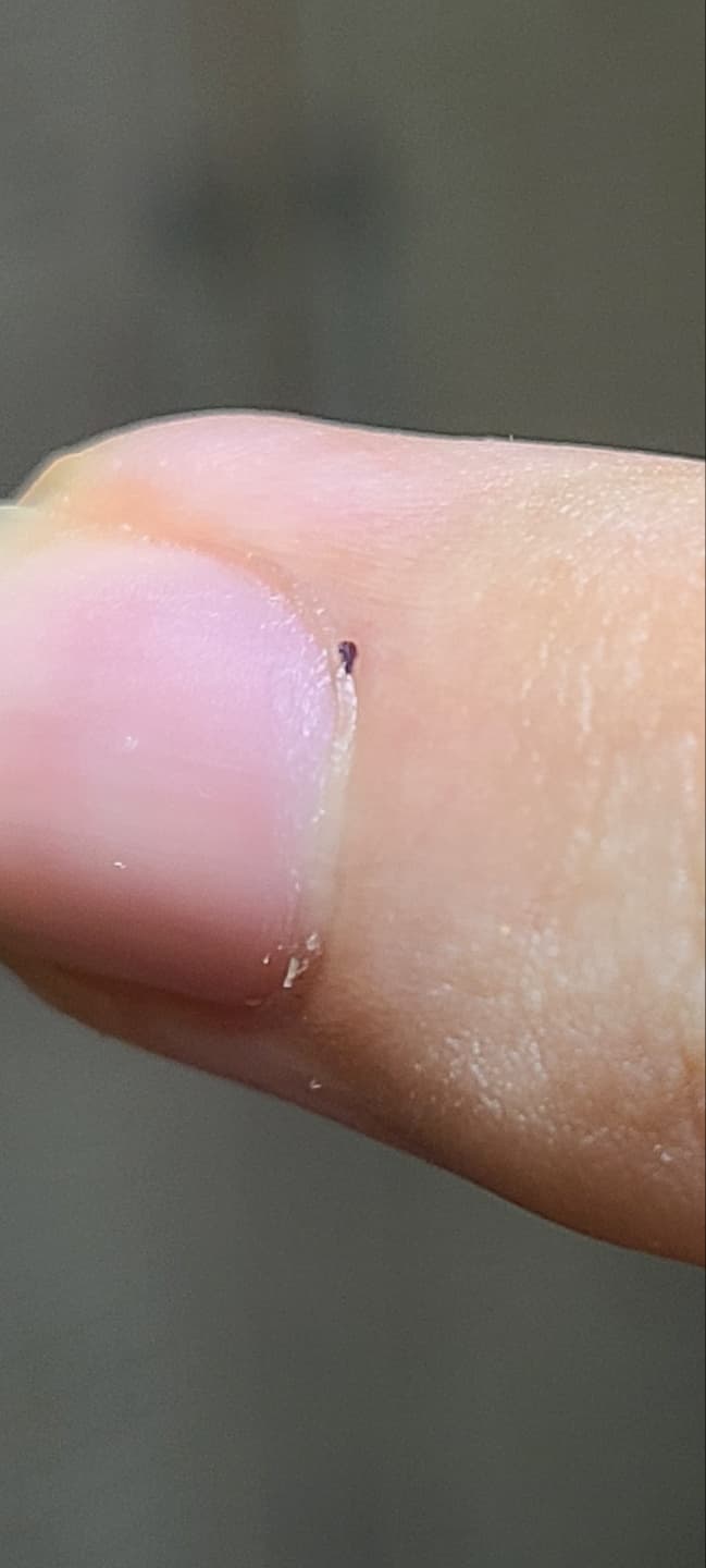 2번 째 사진