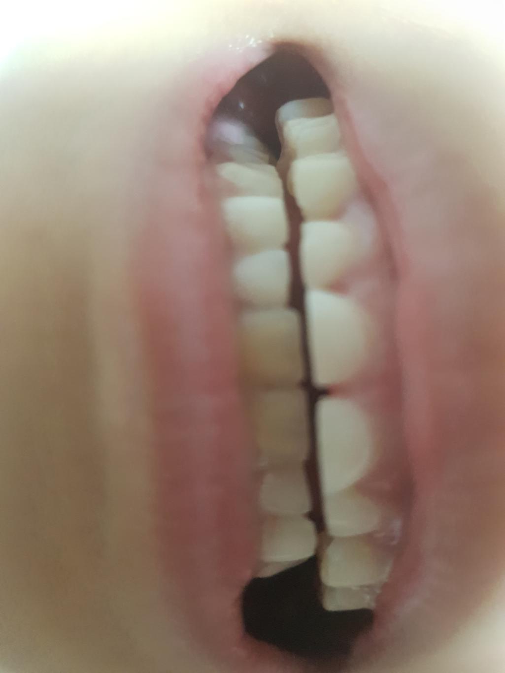 2번 째 사진