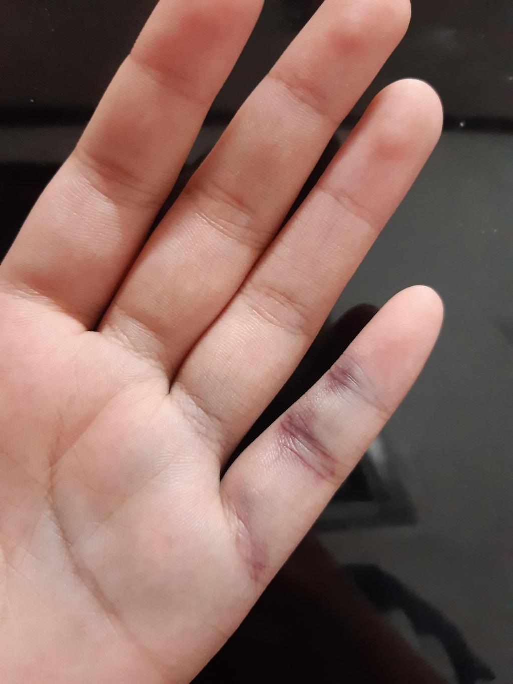 1번 째 사진