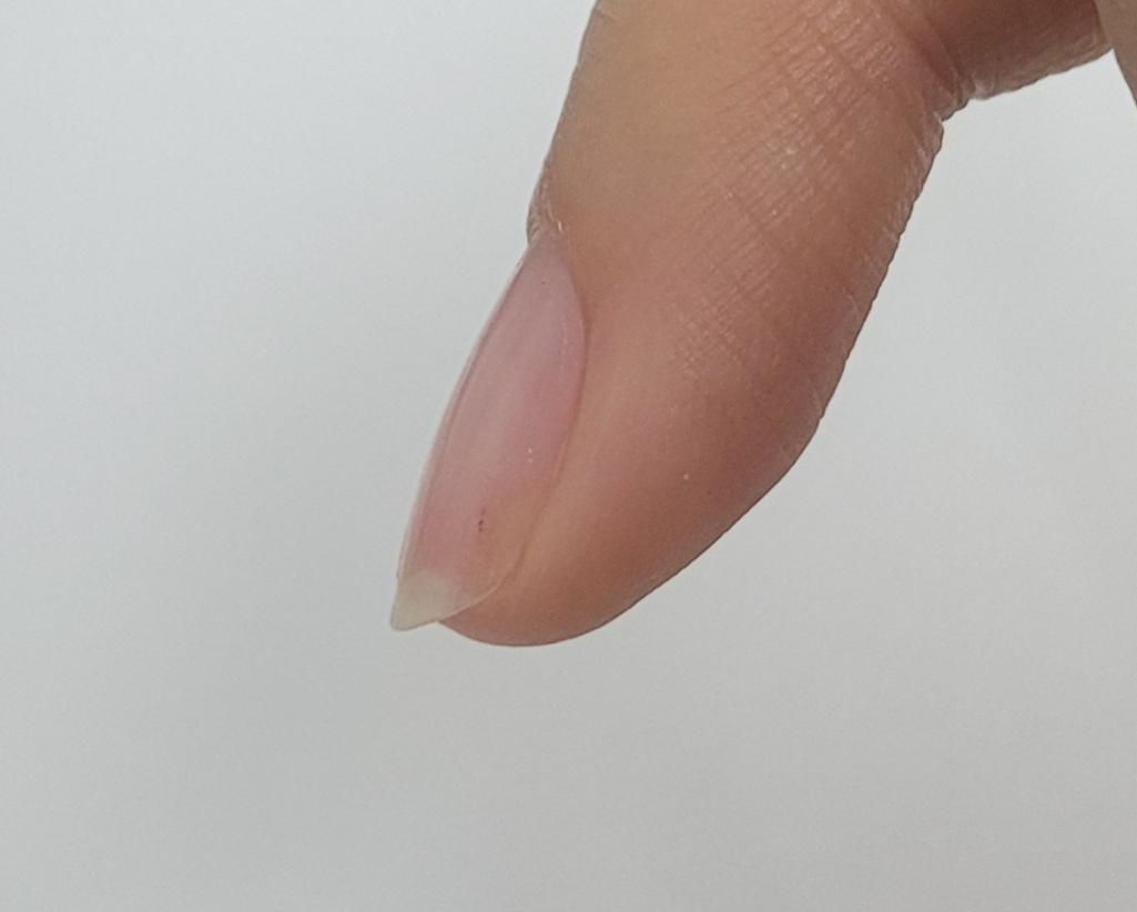 3번 째 사진