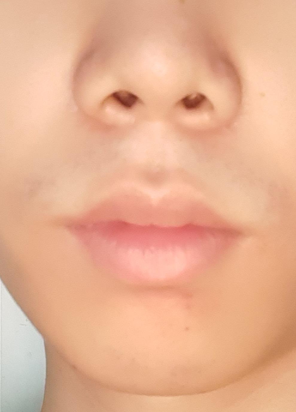 7번 째 사진