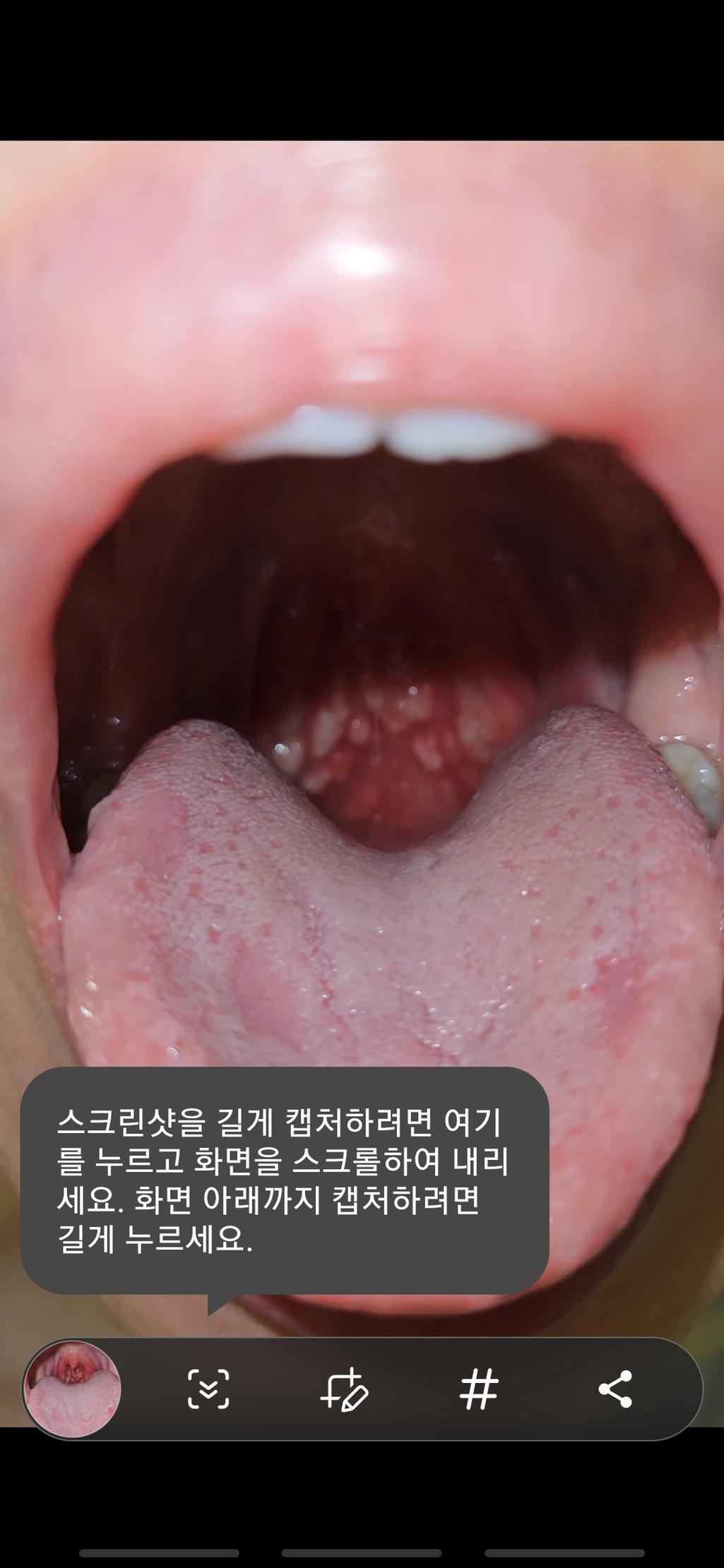 2번 째 사진