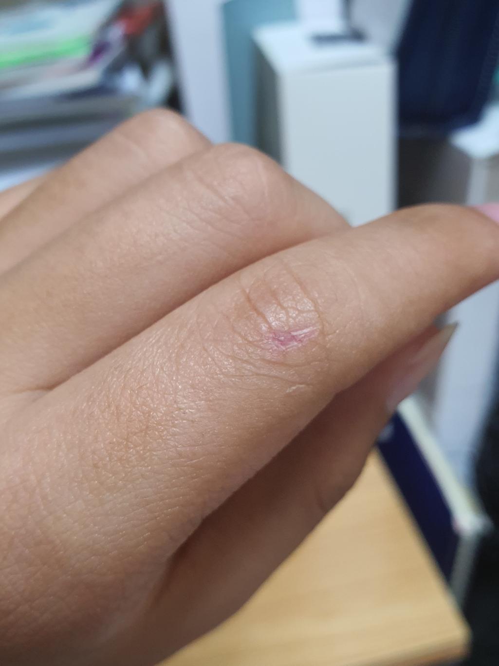 1번 째 사진