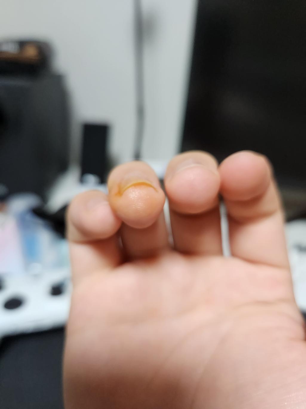 2번 째 사진