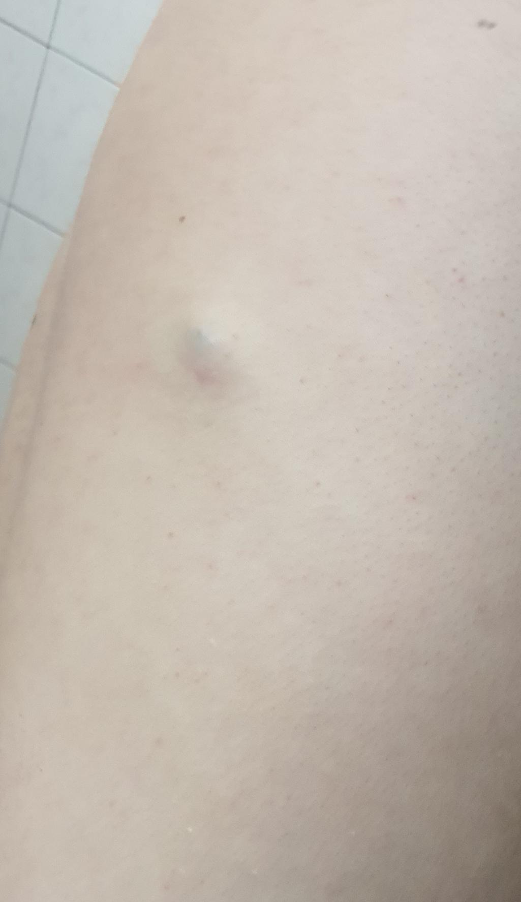 2번 째 사진
