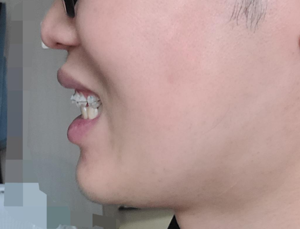 4번 째 사진