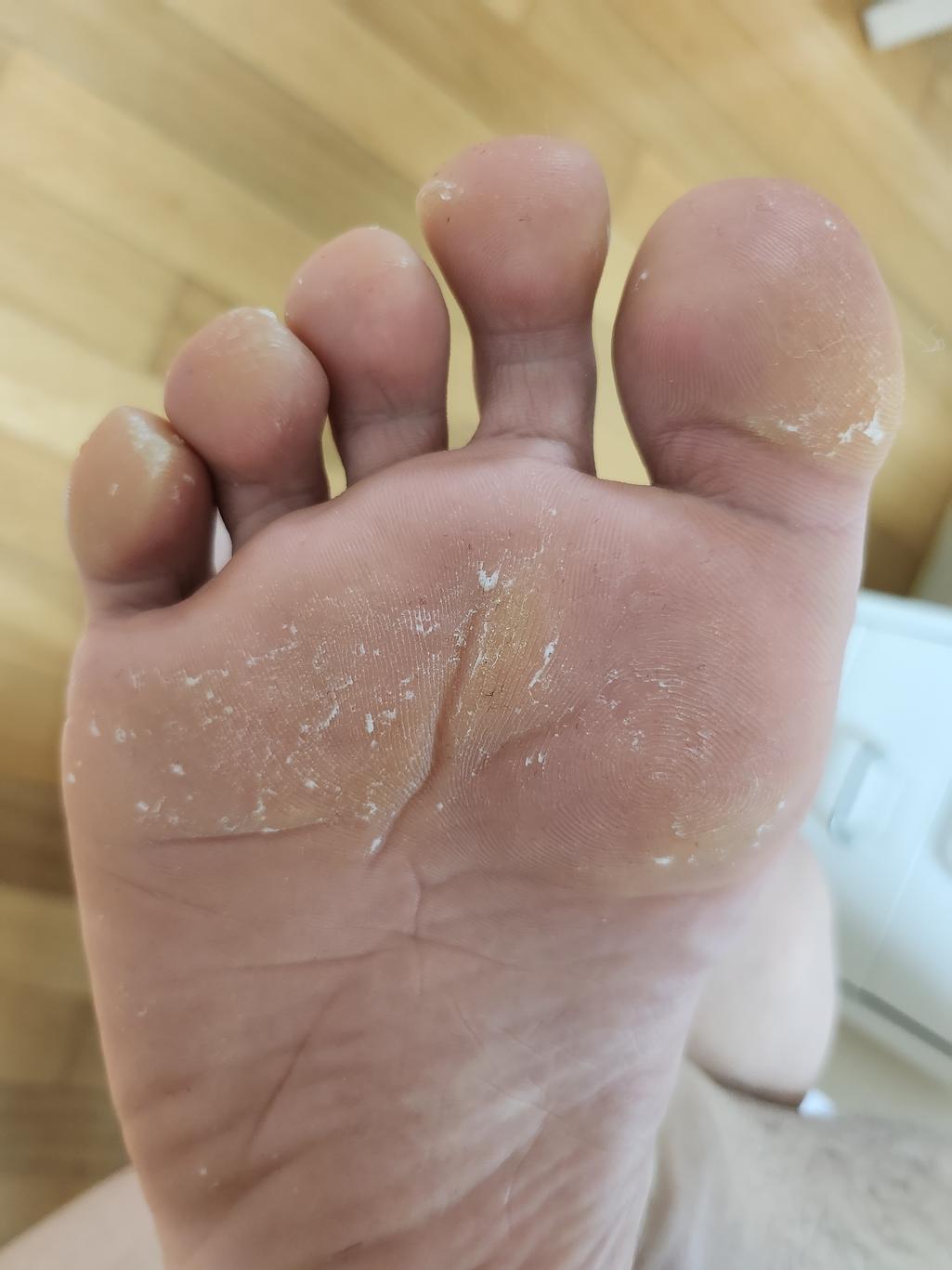 2번 째 사진