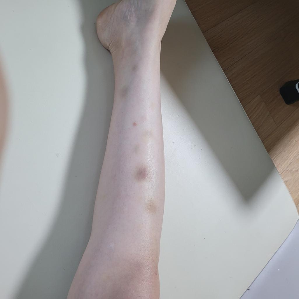 7번 째 사진