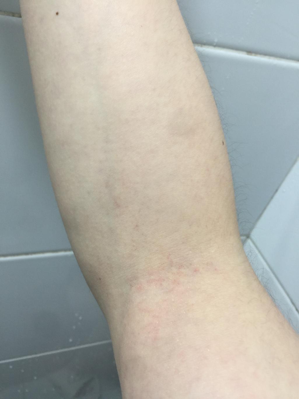 2번 째 사진