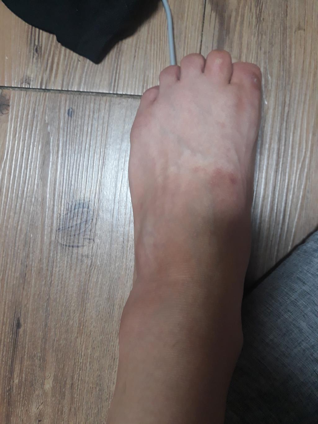 2번 째 사진