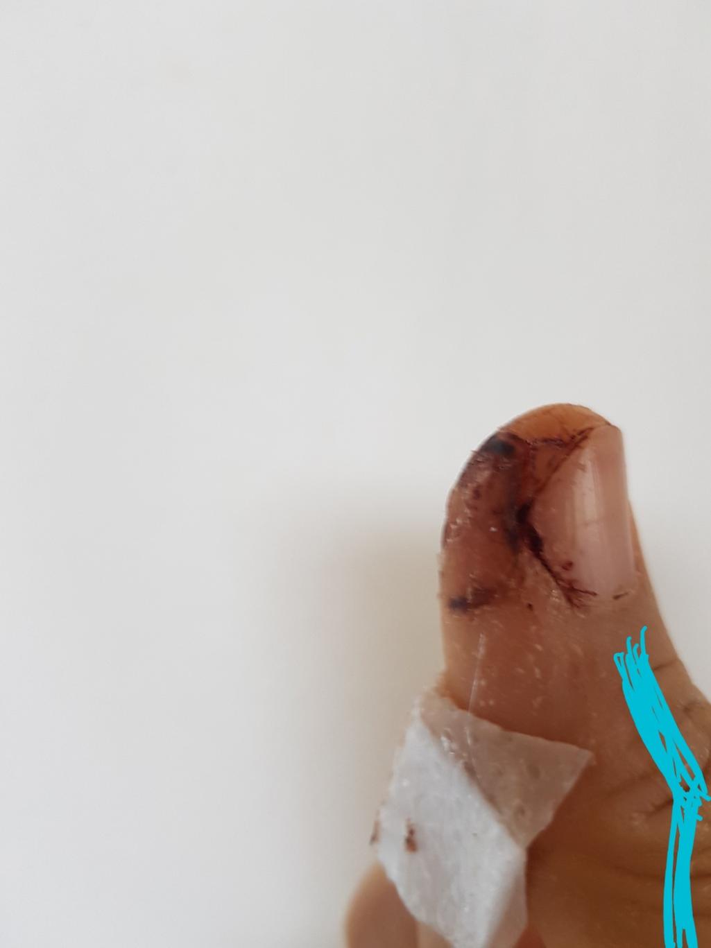 2번 째 사진
