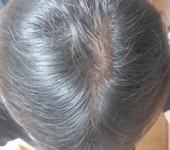 7번 째 사진