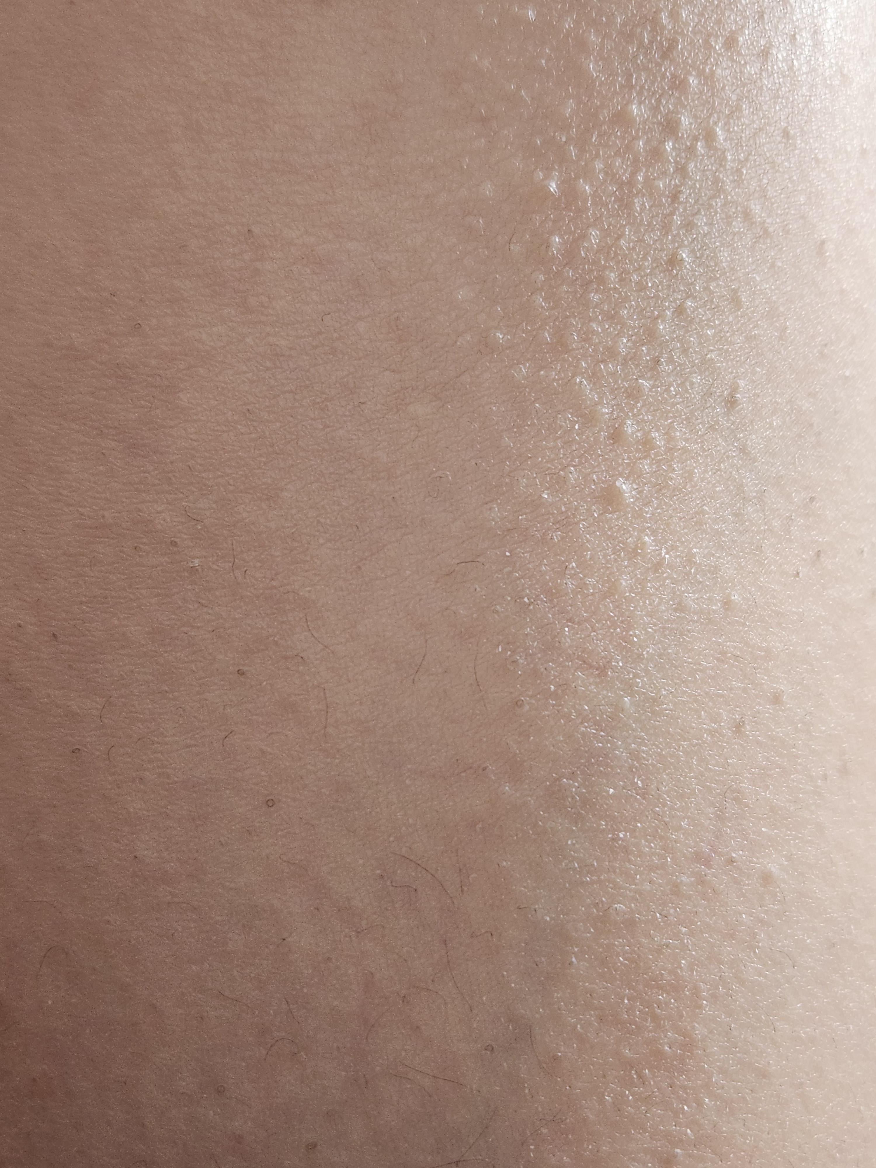 2번 째 사진