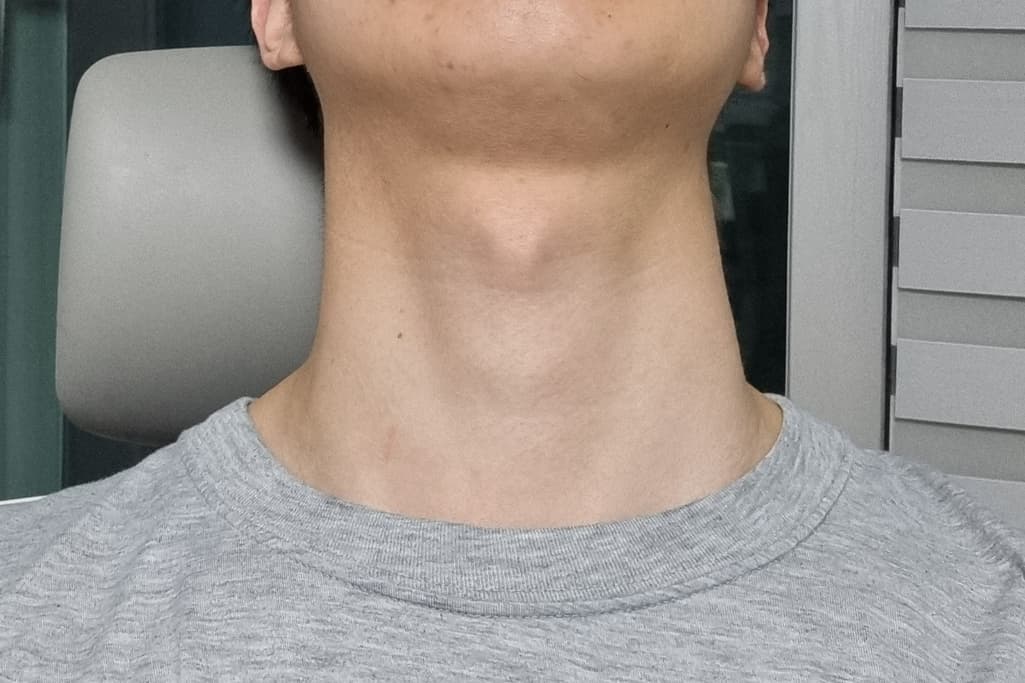1번 째 사진