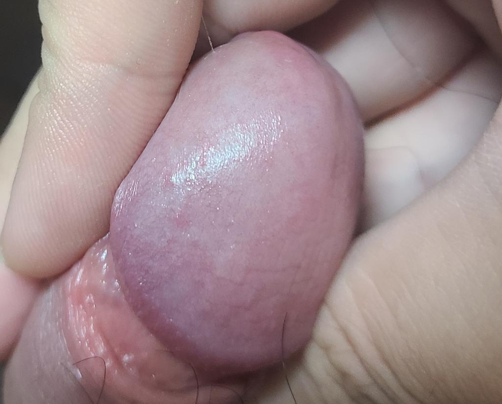 3번 째 사진