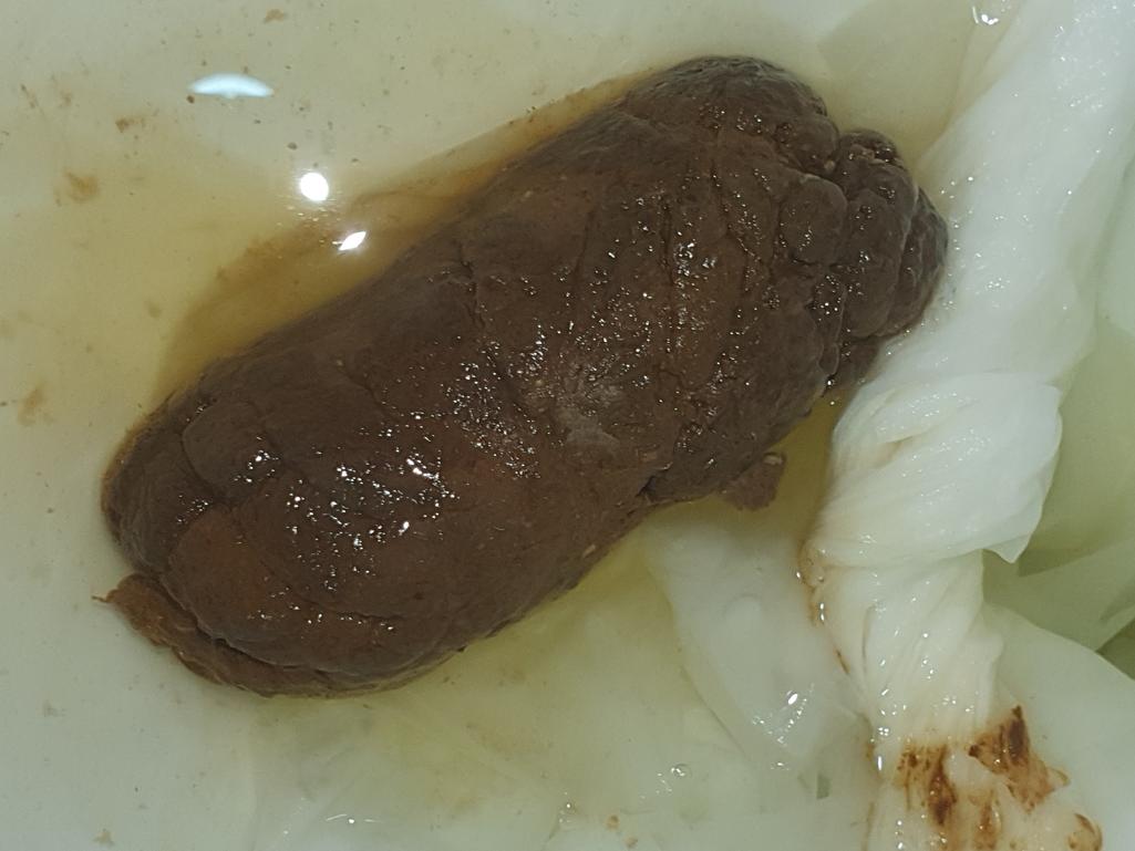 2번 째 사진