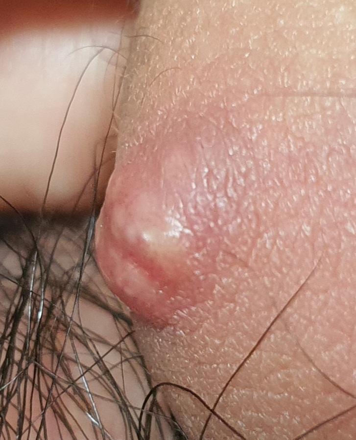 2번 째 사진