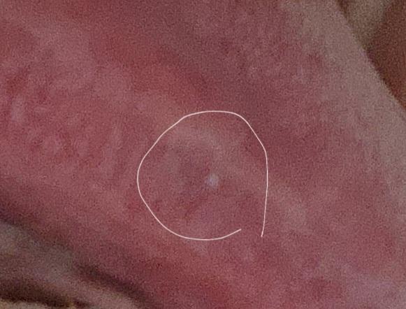 3번 째 사진