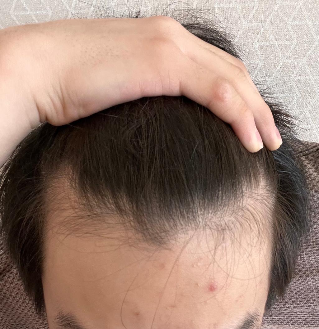 2번 째 사진