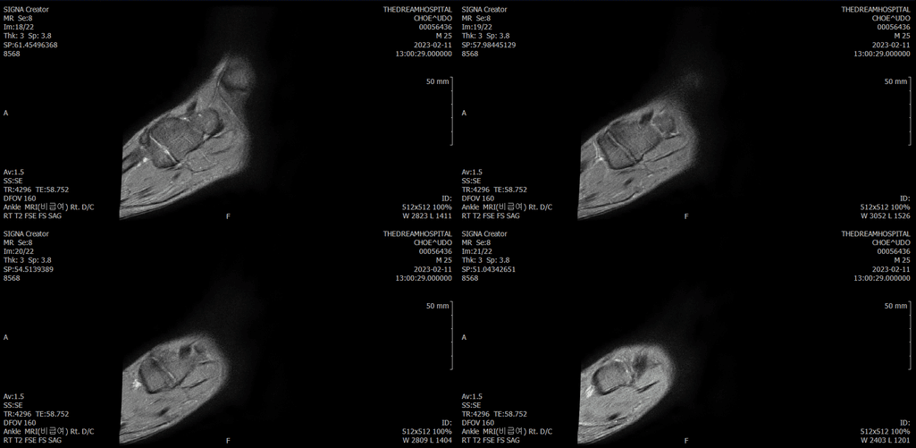 7번 째 사진