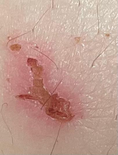 2번 째 사진