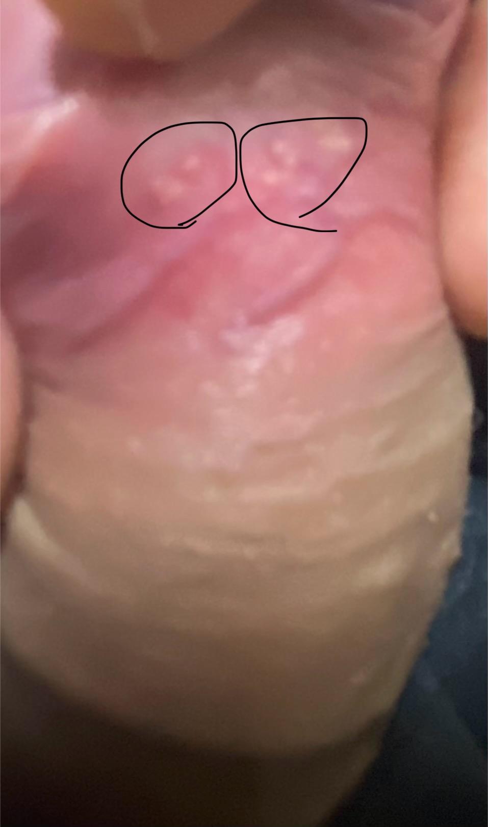 2번 째 사진