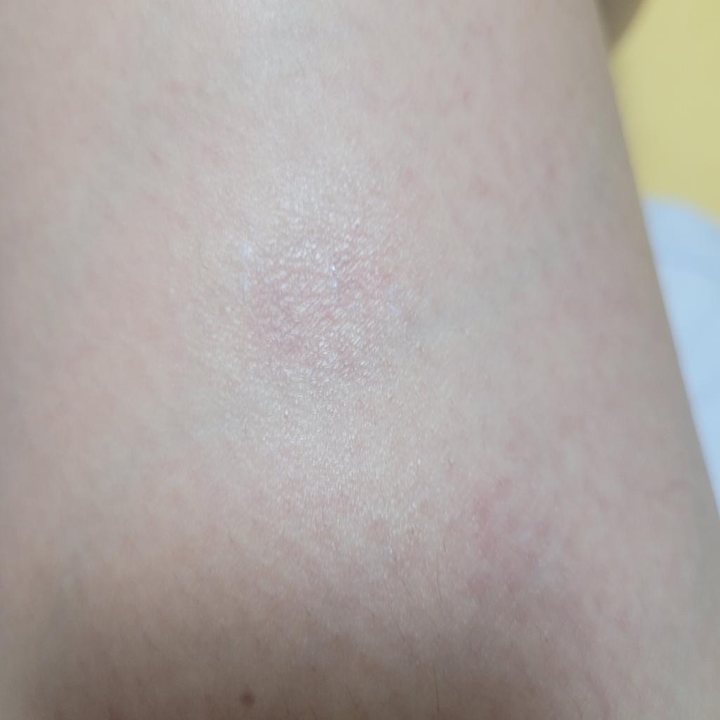 3번 째 사진