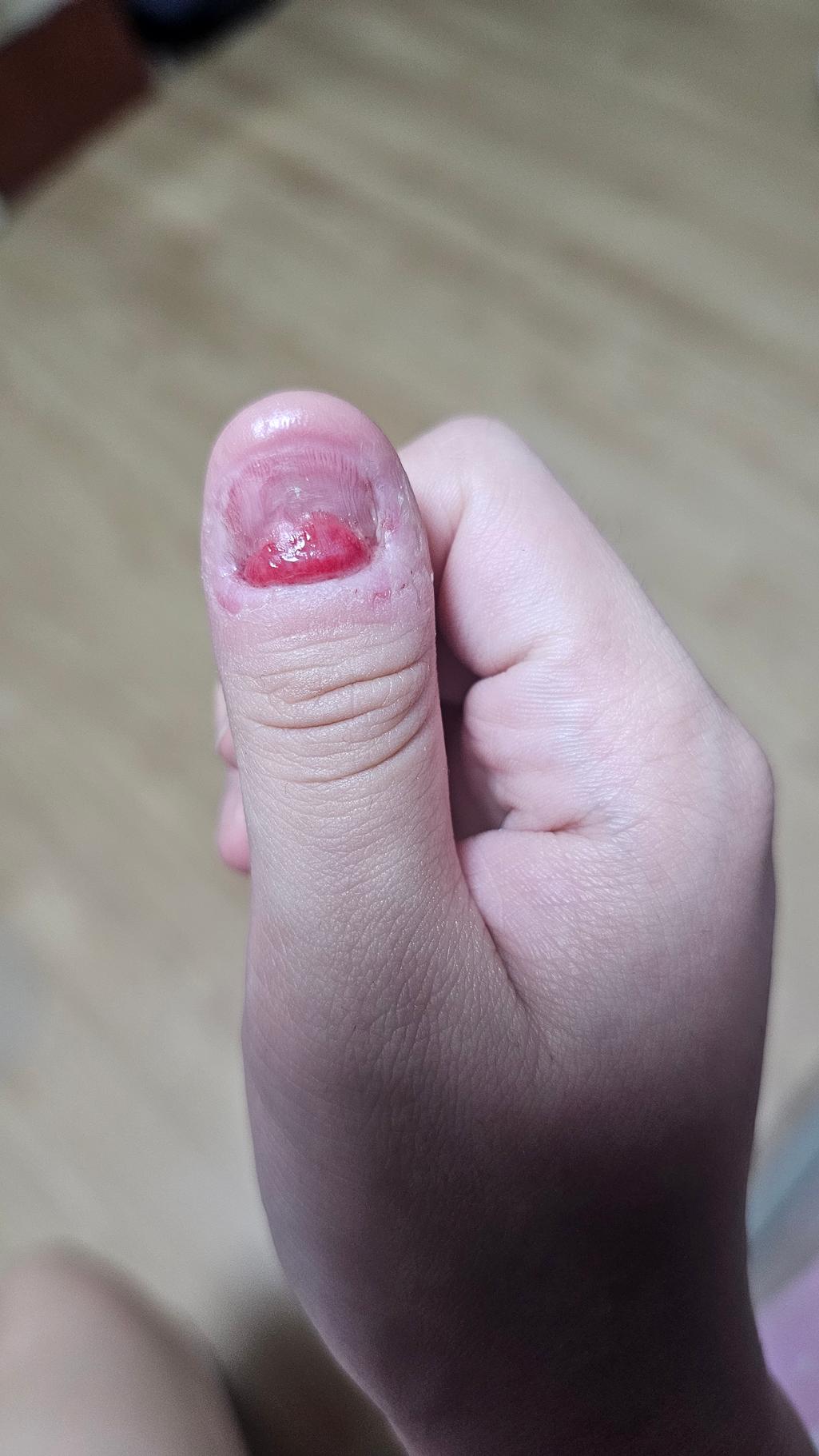 2번 째 사진