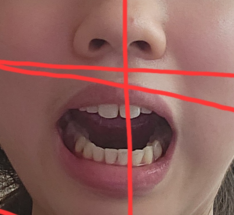3번 째 사진