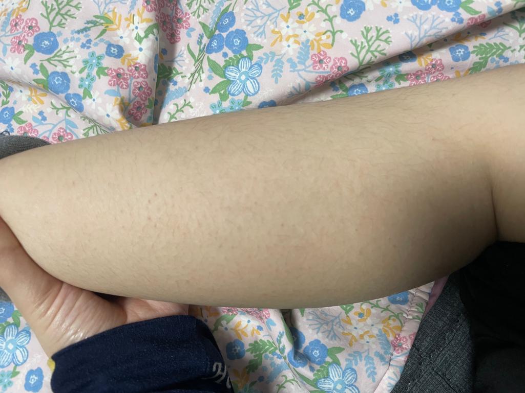2번 째 사진