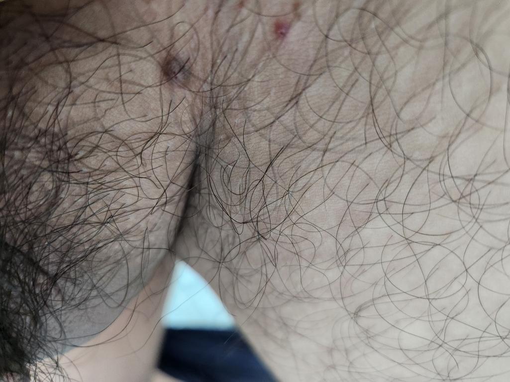 2번 째 사진