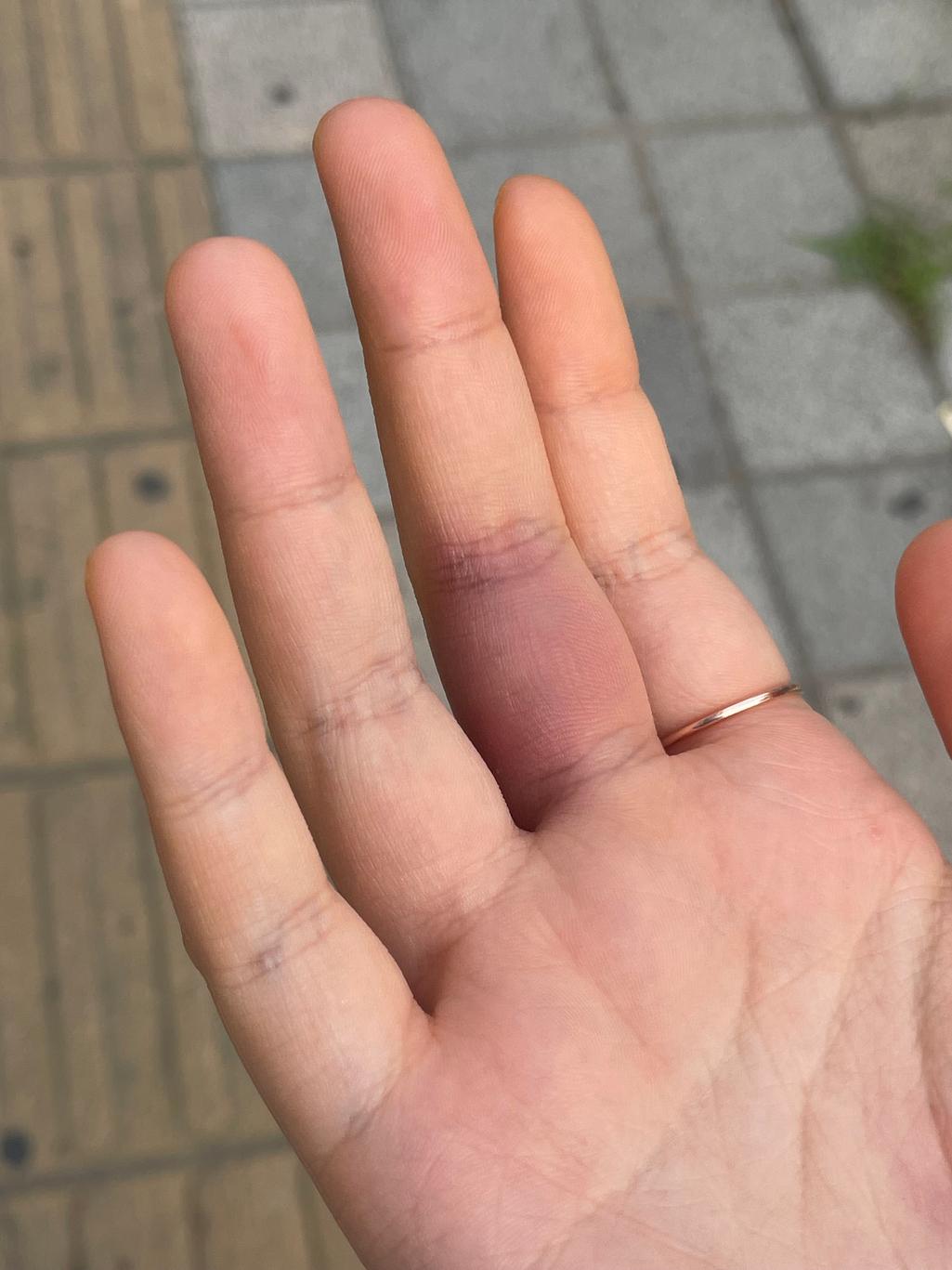 4번 째 사진