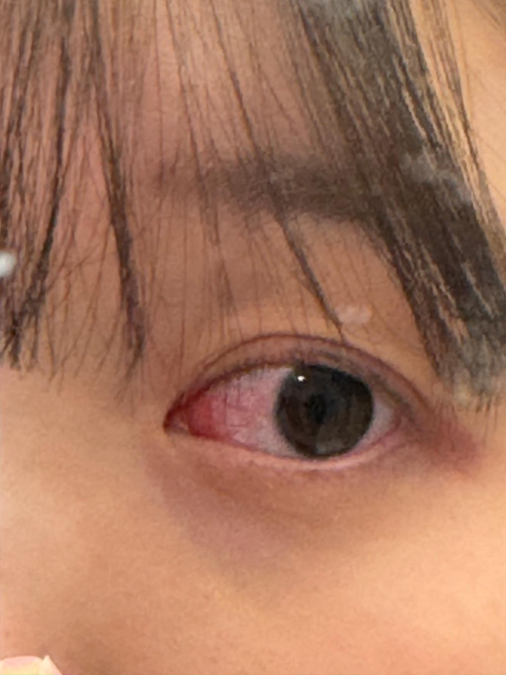 2번 째 사진